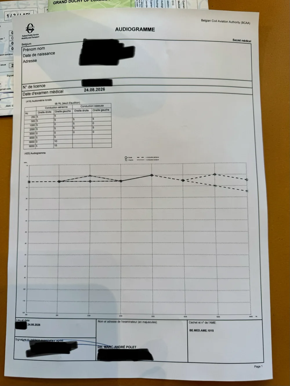 Audiogramme officiel belge : tableau des seuils par fréquence et tracé